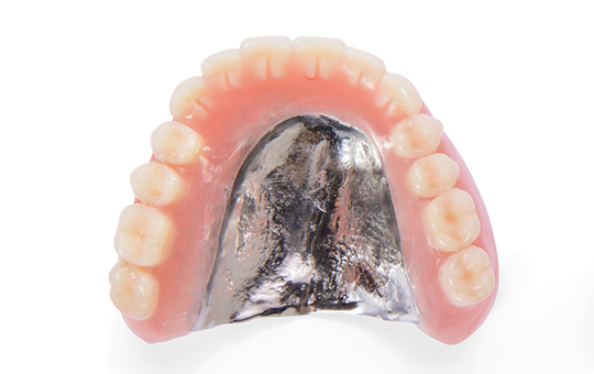 金属床義歯（自費） イメージ画像